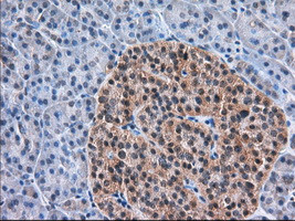 TACC3 Antibody in Immunohistochemistry (Paraffin) (IHC (P))