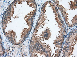 TACC3 Antibody in Immunohistochemistry (Paraffin) (IHC (P))