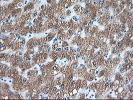 TACC3 Antibody in Immunohistochemistry (Paraffin) (IHC (P))