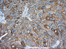 TACC3 Antibody in Immunohistochemistry (Paraffin) (IHC (P))