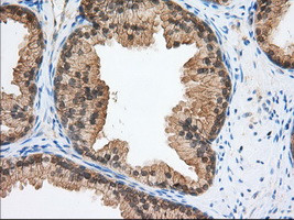 TACC3 Antibody in Immunohistochemistry (Paraffin) (IHC (P))