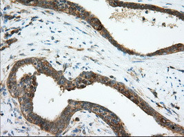 TACC3 Antibody in Immunohistochemistry (Paraffin) (IHC (P))