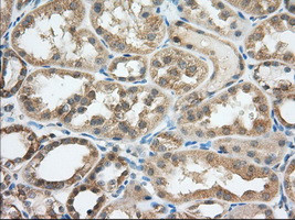 TACC3 Antibody in Immunohistochemistry (Paraffin) (IHC (P))