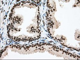 TACC3 Antibody in Immunohistochemistry (Paraffin) (IHC (P))