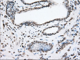 TACC3 Antibody in Immunohistochemistry (Paraffin) (IHC (P))