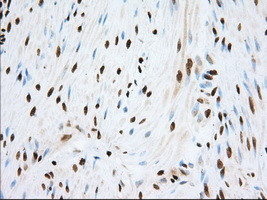 TACC3 Antibody in Immunohistochemistry (Paraffin) (IHC (P))