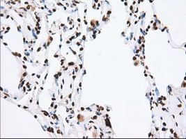 TACC3 Antibody in Immunohistochemistry (Paraffin) (IHC (P))