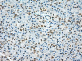 TACC3 Antibody in Immunohistochemistry (Paraffin) (IHC (P))