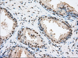 TACC3 Antibody in Immunohistochemistry (Paraffin) (IHC (P))