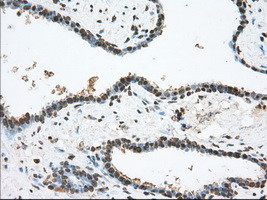 TACC3 Antibody in Immunohistochemistry (Paraffin) (IHC (P))