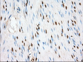 TACC3 Antibody in Immunohistochemistry (Paraffin) (IHC (P))