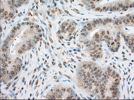 TACC3 Antibody in Immunohistochemistry (Paraffin) (IHC (P))