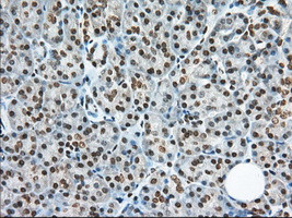 TACC3 Antibody in Immunohistochemistry (Paraffin) (IHC (P))