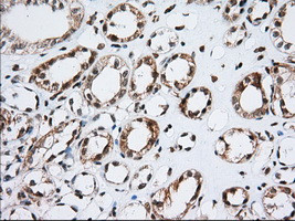 TACC3 Antibody in Immunohistochemistry (Paraffin) (IHC (P))