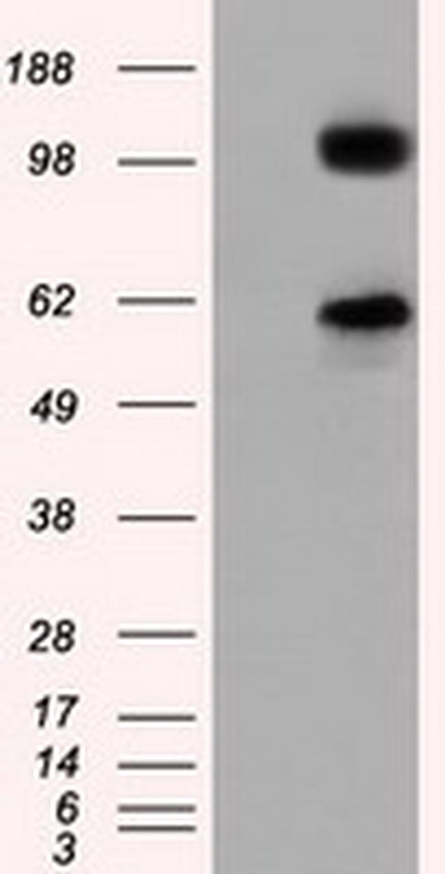 TACC3 Antibody in Western Blot (WB)