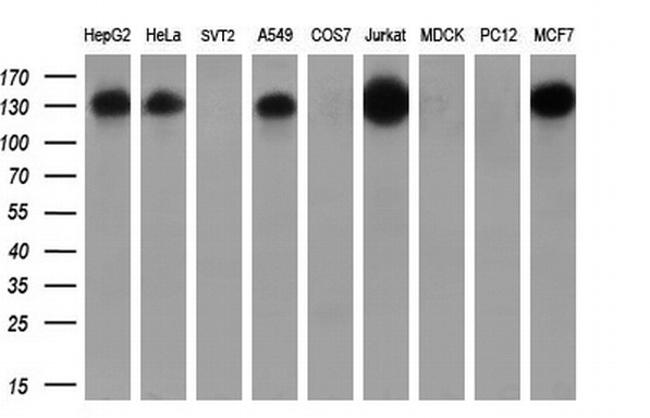 TACC3 Antibody in Western Blot (WB)