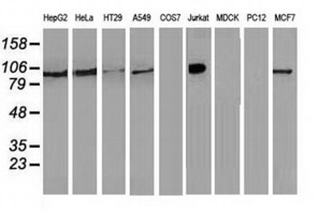 TACC3 Antibody in Western Blot (WB)