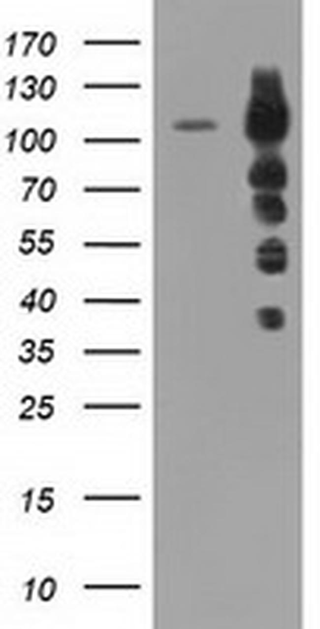 TACC3 Antibody in Western Blot (WB)