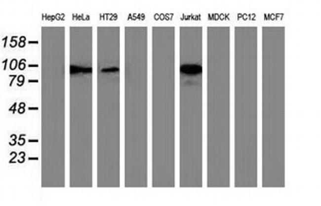 TACC3 Antibody in Western Blot (WB)