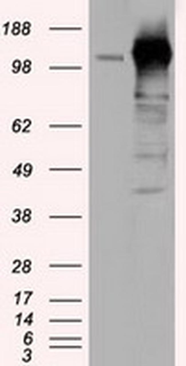 TACC3 Antibody in Western Blot (WB)