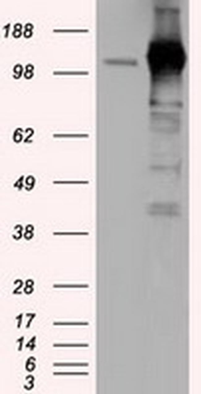 TACC3 Antibody in Western Blot (WB)