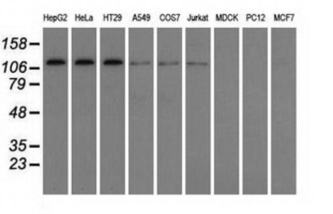 TACC3 Antibody in Western Blot (WB)