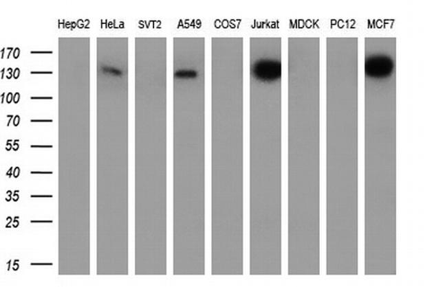 TACC3 Antibody in Western Blot (WB)