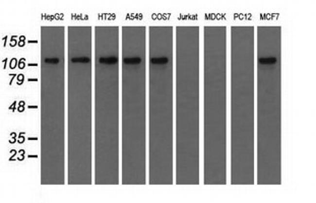 TACC3 Antibody in Western Blot (WB)