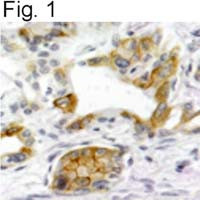 TACR1 Antibody in Immunohistochemistry (Paraffin) (IHC (P))