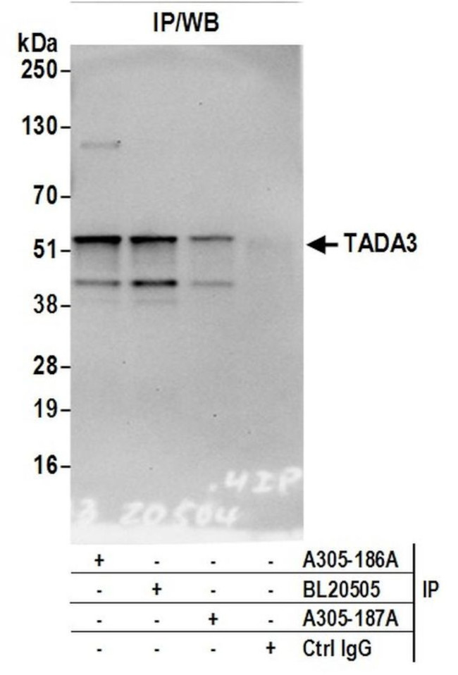 TADA3/TADA3L Antibody in Immunoprecipitation (IP)