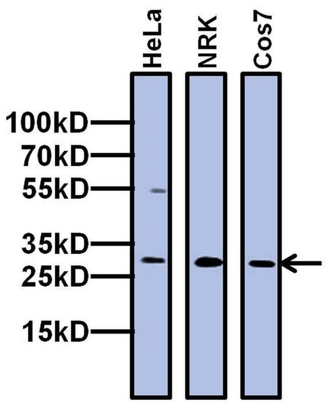 TAF10 Antibody in Western Blot (WB)