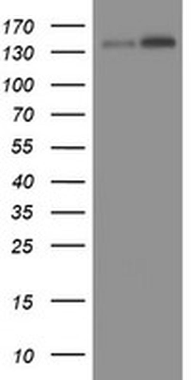 TAF2 Antibody in Western Blot (WB)