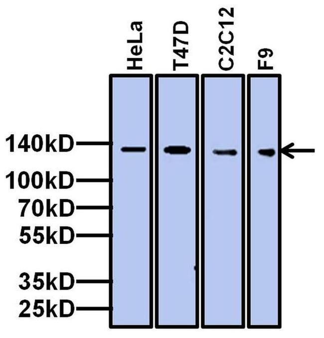 TAF4 Antibody in Western Blot (WB)