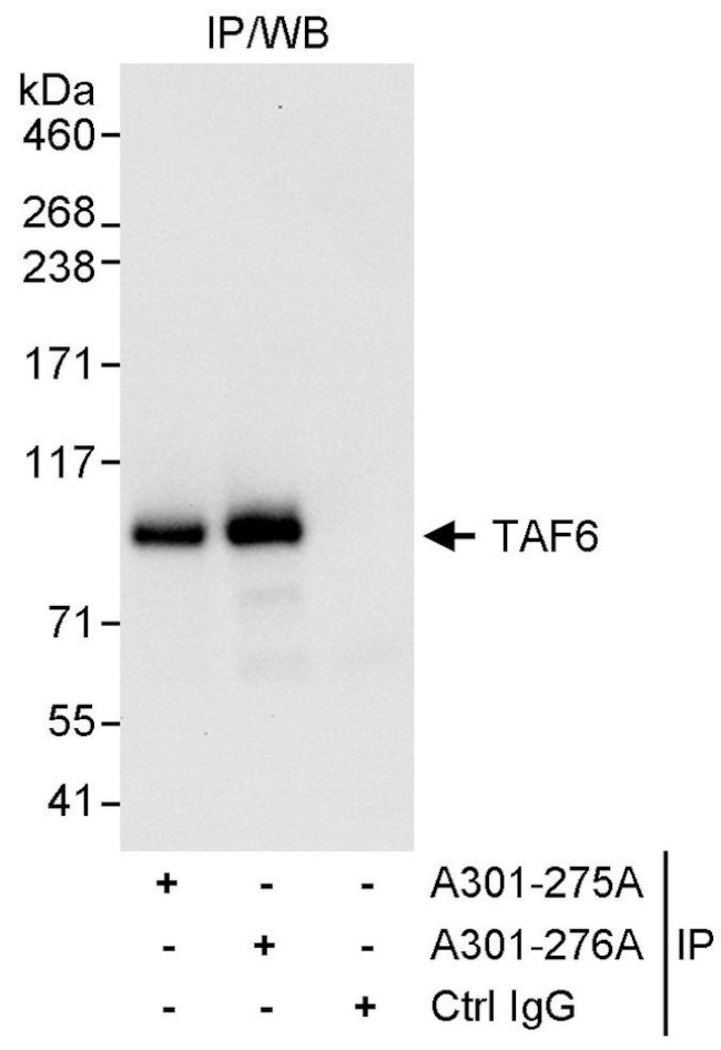 TAF6 Antibody in Immunoprecipitation (IP)
