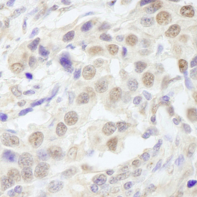 TAF6 Antibody in Immunohistochemistry (IHC)