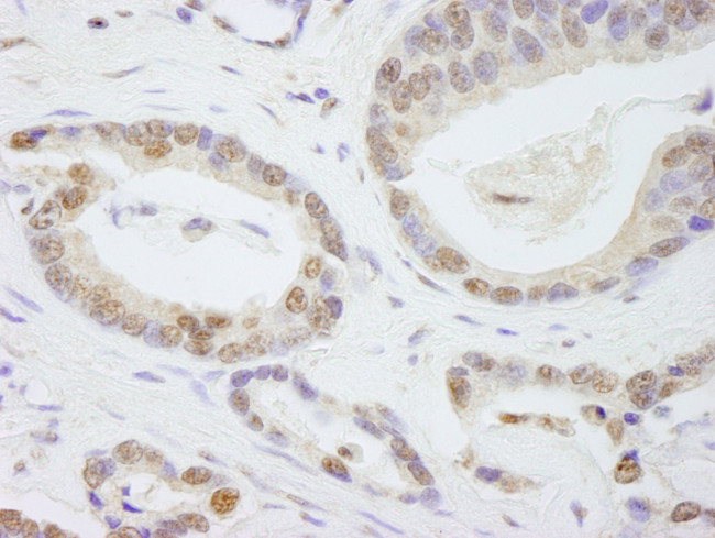 TAF6 Antibody in Immunohistochemistry (IHC)