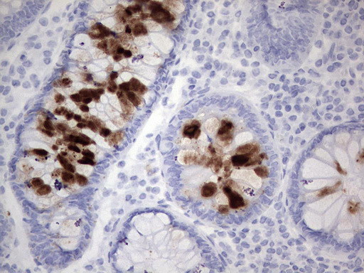 TAG-72/CA 72-4 Antibody in Immunohistochemistry (Paraffin) (IHC (P))