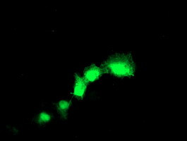 TAGLN Antibody in Immunocytochemistry (ICC/IF)