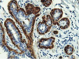 TAGLN Antibody in Immunohistochemistry (Paraffin) (IHC (P))