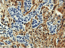 TAGLN Antibody in Immunohistochemistry (Paraffin) (IHC (P))