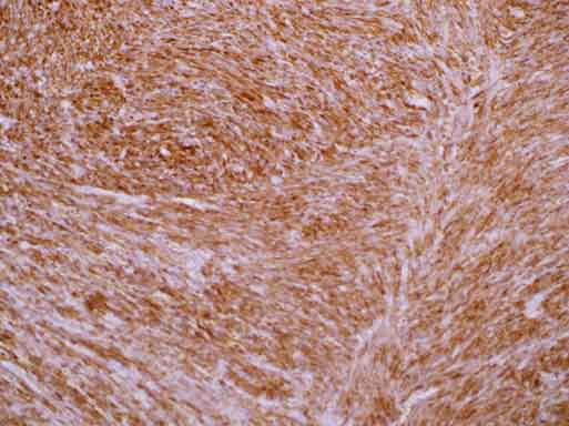 TAGLN Antibody in Immunohistochemistry (Paraffin) (IHC (P))