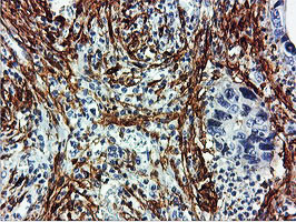 TAGLN Antibody in Immunohistochemistry (Paraffin) (IHC (P))