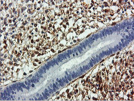 TAGLN Antibody in Immunohistochemistry (Paraffin) (IHC (P))