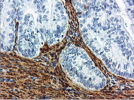 TAGLN Antibody in Immunohistochemistry (Paraffin) (IHC (P))