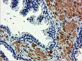 TAGLN Antibody in Immunohistochemistry (Paraffin) (IHC (P))