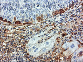 TAGLN Antibody in Immunohistochemistry (Paraffin) (IHC (P))