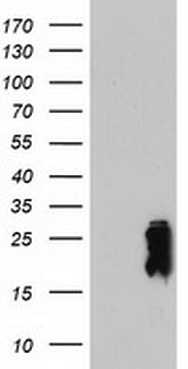 TAGLN Antibody in Western Blot (WB)