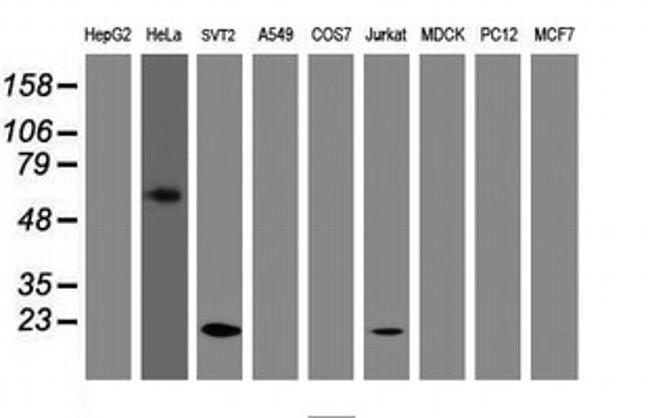 TAGLN Antibody in Western Blot (WB)