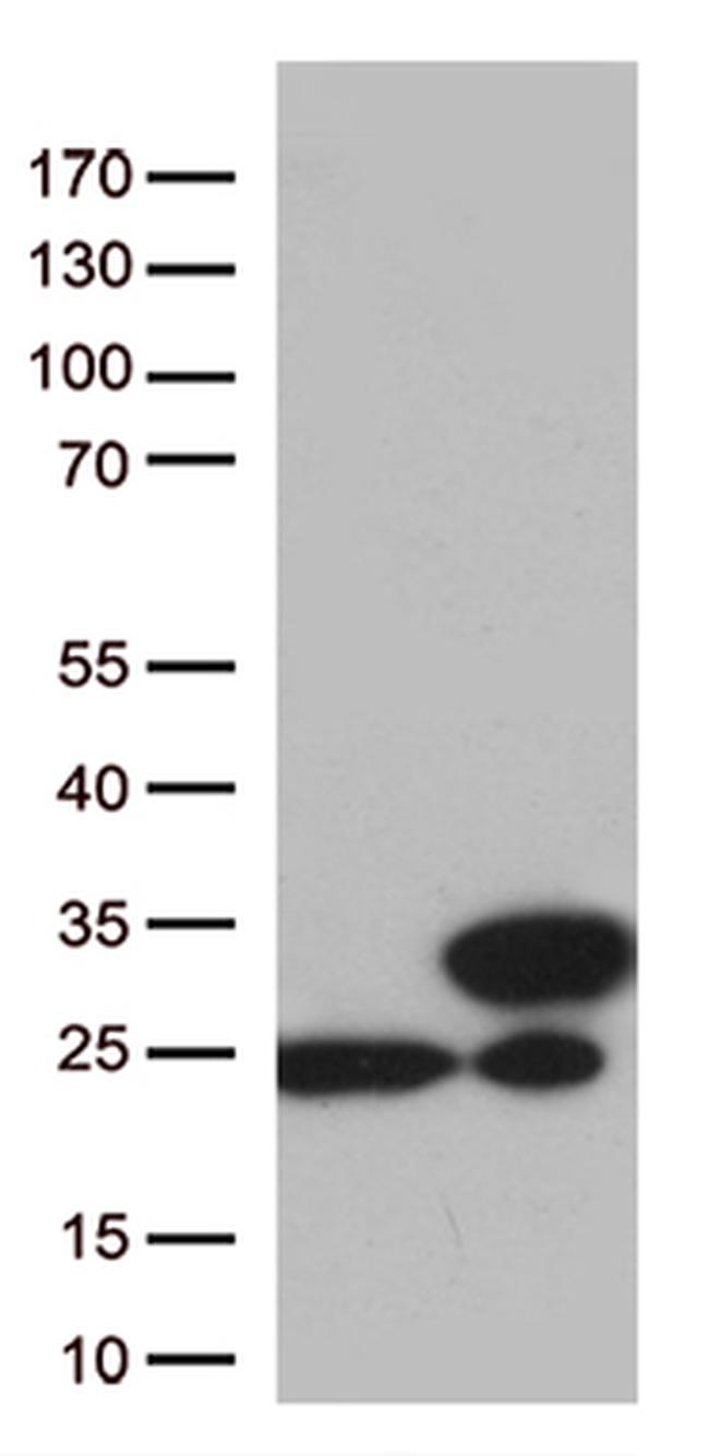 TAGLN2 Antibody in Western Blot (WB)