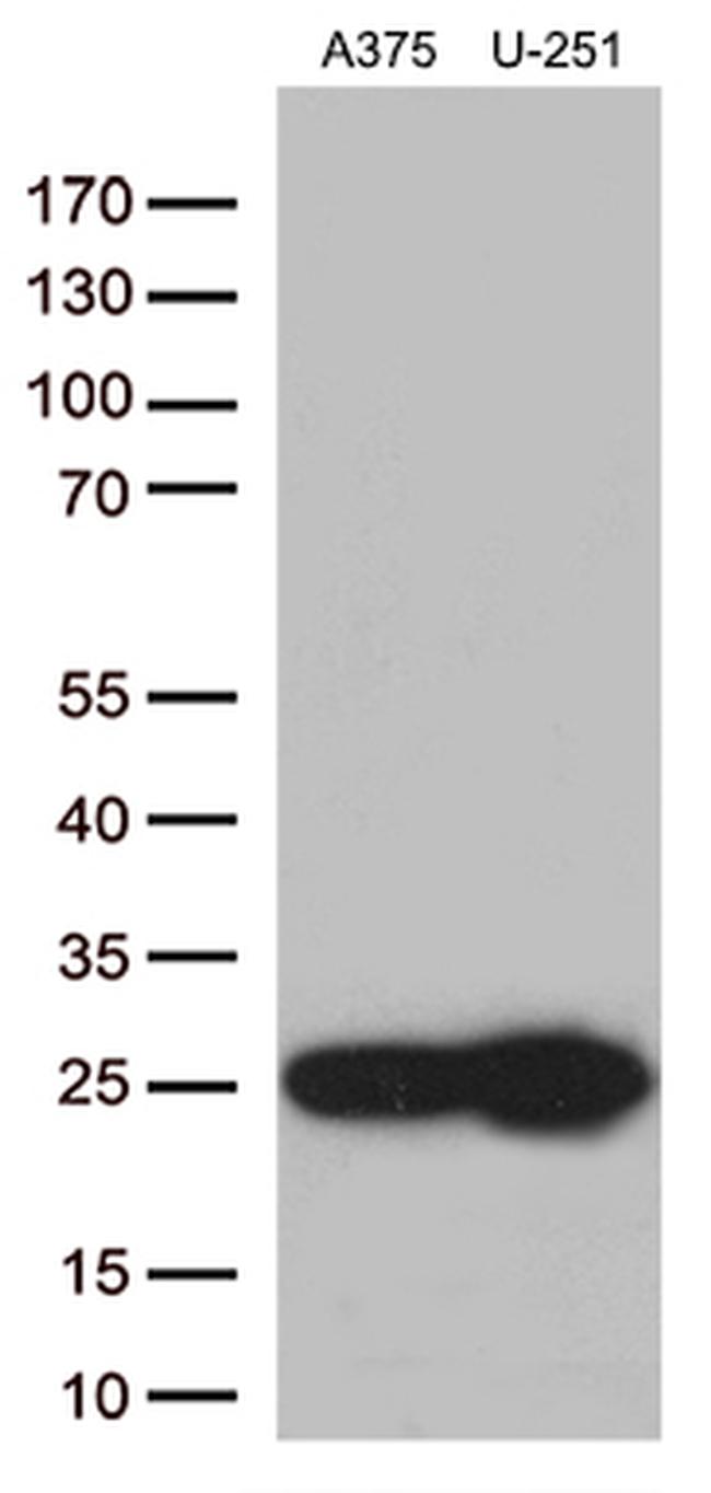 TAGLN2 Antibody in Western Blot (WB)